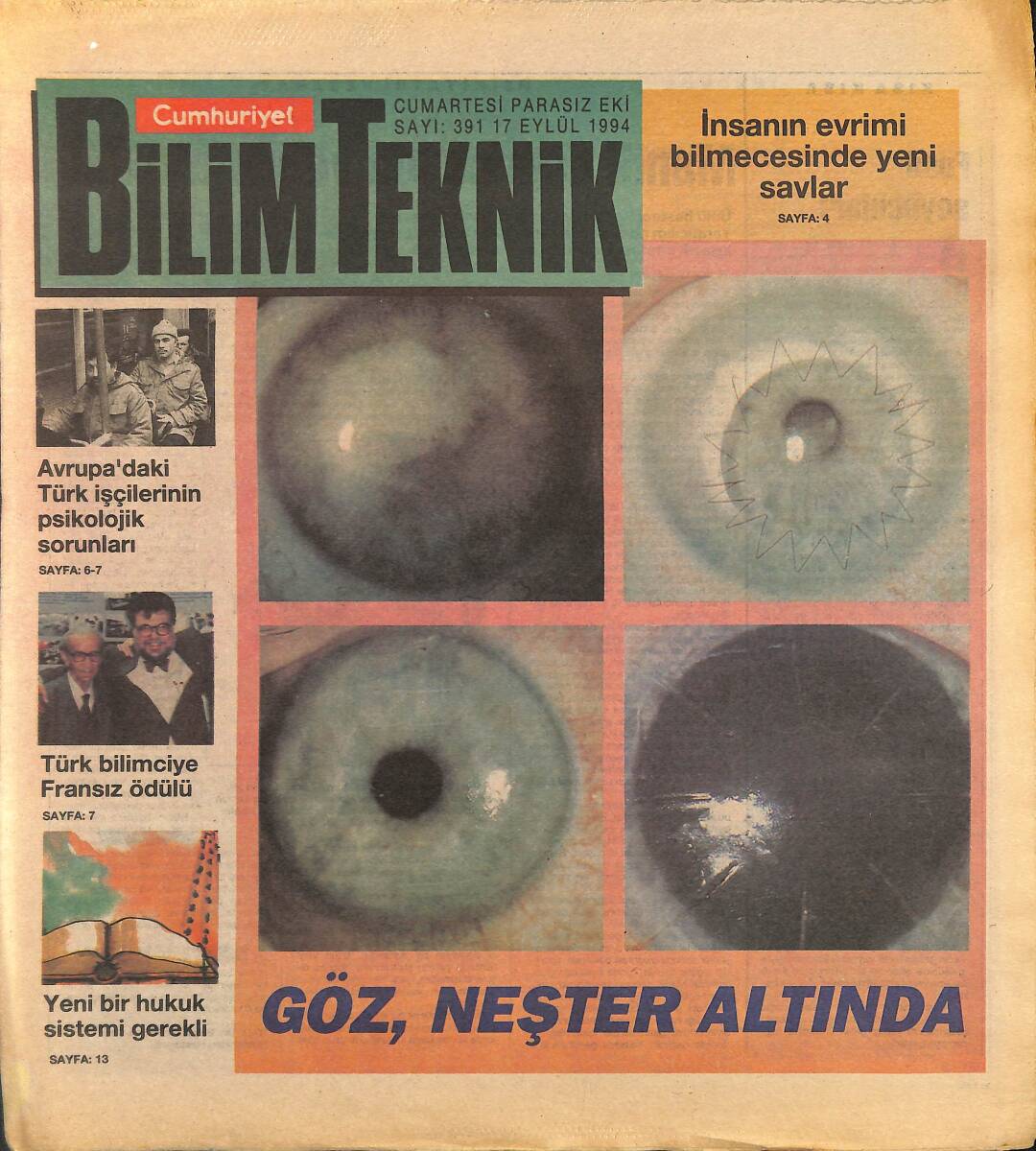 Cumhuriyet Gazetesi Bilim Teknik Eki 17 Eylül 1994 - Göz , Neşter Altında - Avrupa'daki Türk İşçilerin Psikolojik Sorunları GZ155695 - 1