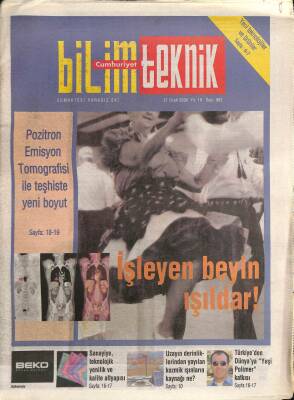 Cumhuriyet Gazetesi Bilim Teknik Eki 21 Ocak 2006 - Pozitron Emisyon Tomografisi İle Teşhise Yeni Boyut GZ96658 - 1