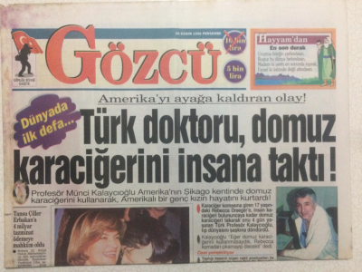 Gözcü Gazetesi 28 Kasım 1996 - Türk Doktoru Domuz Karaciğerini İnsana Taktı GZ24295 - 1