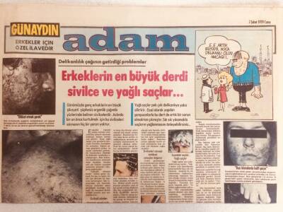 Günaydın Gazetesi Adam Eki 2 Şubat 1979 - Erkeklerin En Büyük Derdi Yağlı Saçlar GZ38934 - 1