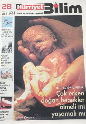Hürriyet Gazetesi 28 Eylül 2002 Bilim Eki Sayı38-Tıpta Büyük Çatışma Çok Erken Doğan Bebekler Ölmeli Mi Yaşamalı Mı GZ30552 - 1