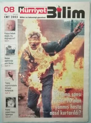 Hürriyet Gazetesi Bilim Eki 8 Mart 2003 Yaşama Şansı Yüzde 10 Olan Yanmış Hasta Nasıl Kurtarıldı -GZ33204 - 1