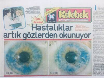 Hürriyet Gazetesi Kelebek Eki 22 Mayıs 1982 - Hastalıklar Artık Gözlerden Okunuyor GZ42257 - 1