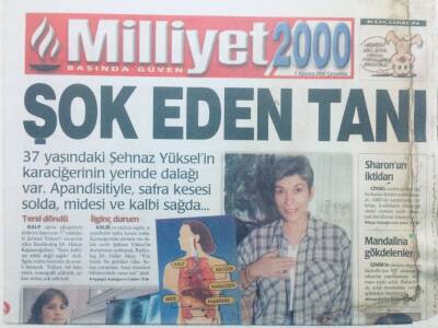 Milliyet Gazetesi 2000 Eki 2 Ağustos 2000 - Şok Eden Tanı GZ42366 - 1