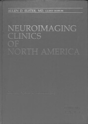 Neuroimaging - Clinics Of North America - February 1994 Volume 4 NUMBER 1 (Contrast Agents In Neuroimaging) NDR89307 - Gökçekoleksiyon