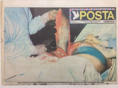 Posta Gazetesi Magazin Eki 27 Temmuz 1985 - 18 KG Yağ Aldırdı GZ35766 - 1