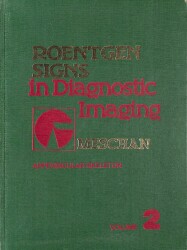 Roentgen Signs in Diagnostic Imaging: The Chest VOL 2 NDR89294 - Gökçekoleksiyon