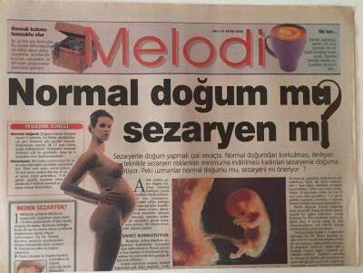 Sabah Gazetesi Melodi Eki 24 Ekim 2000 - Normal Doğum Mu Sezaryen Mi ? GZ22925 - 1